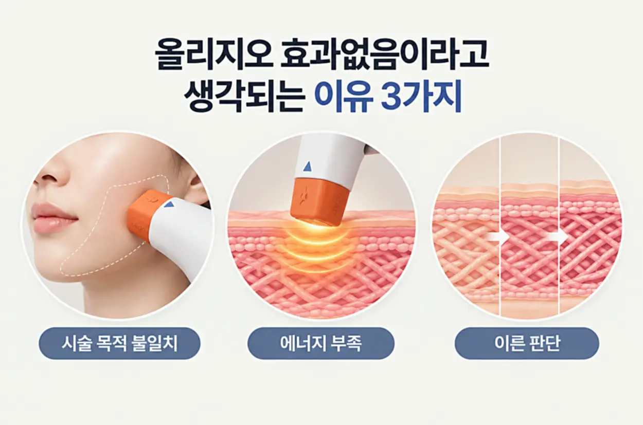 올리지오 효과없음이라고 느끼는 3가지 이유인 시술 목적 불일치, 에너지 부족, 이른 판단을 시술 장면과 피부 단면 일러스트로 설명한 이미지