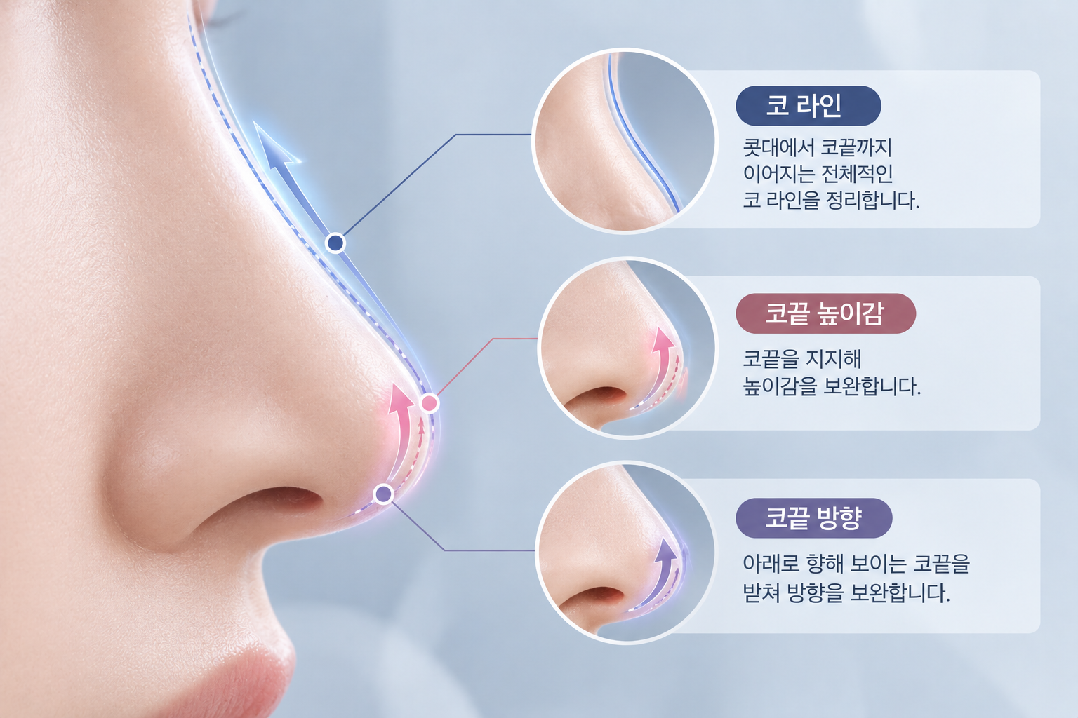 코 실리프팅으로 보완할 수 있는 코끝 방향, 높이감, 코 라인 변화 범위