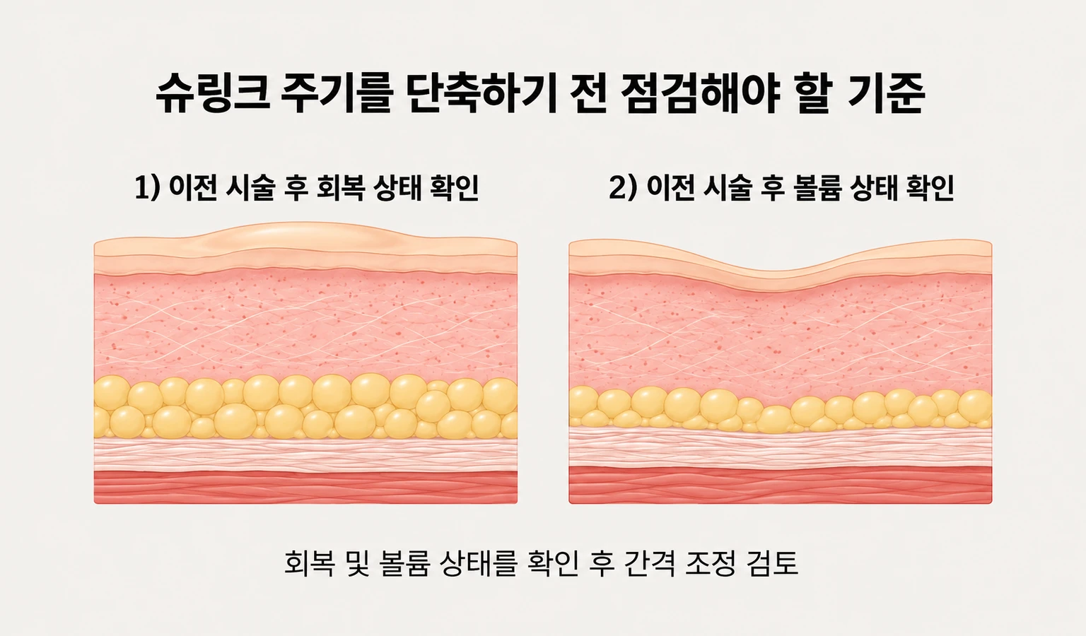 슈링크 주기 단축 전 이전 시술 부위의 회복·볼륨 상태와 간격 조정 기준