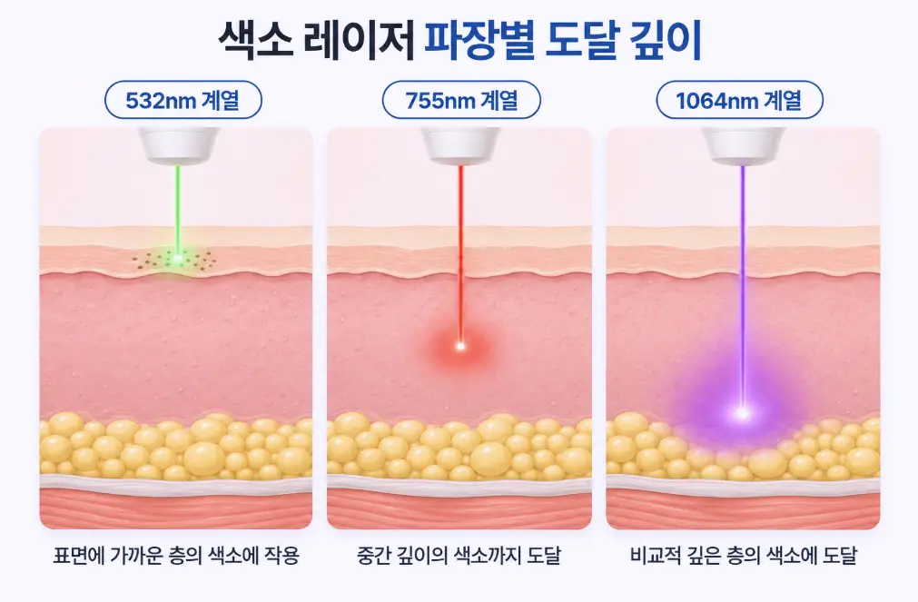 532나노미터, 755나노미터, 1064나노미터 색소 레이저 파장별 피부 침투 깊이와 도달 층을 비교한 단면 인포그래픽