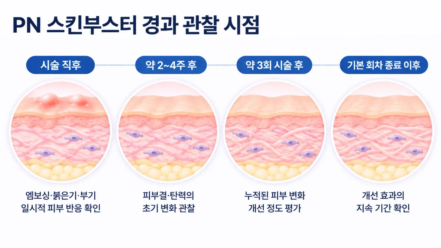 PN 스킨부스터 시술 후 피부결과 탄력 변화 및 경과 관찰 시점을 비교한 의료 인포그래픽