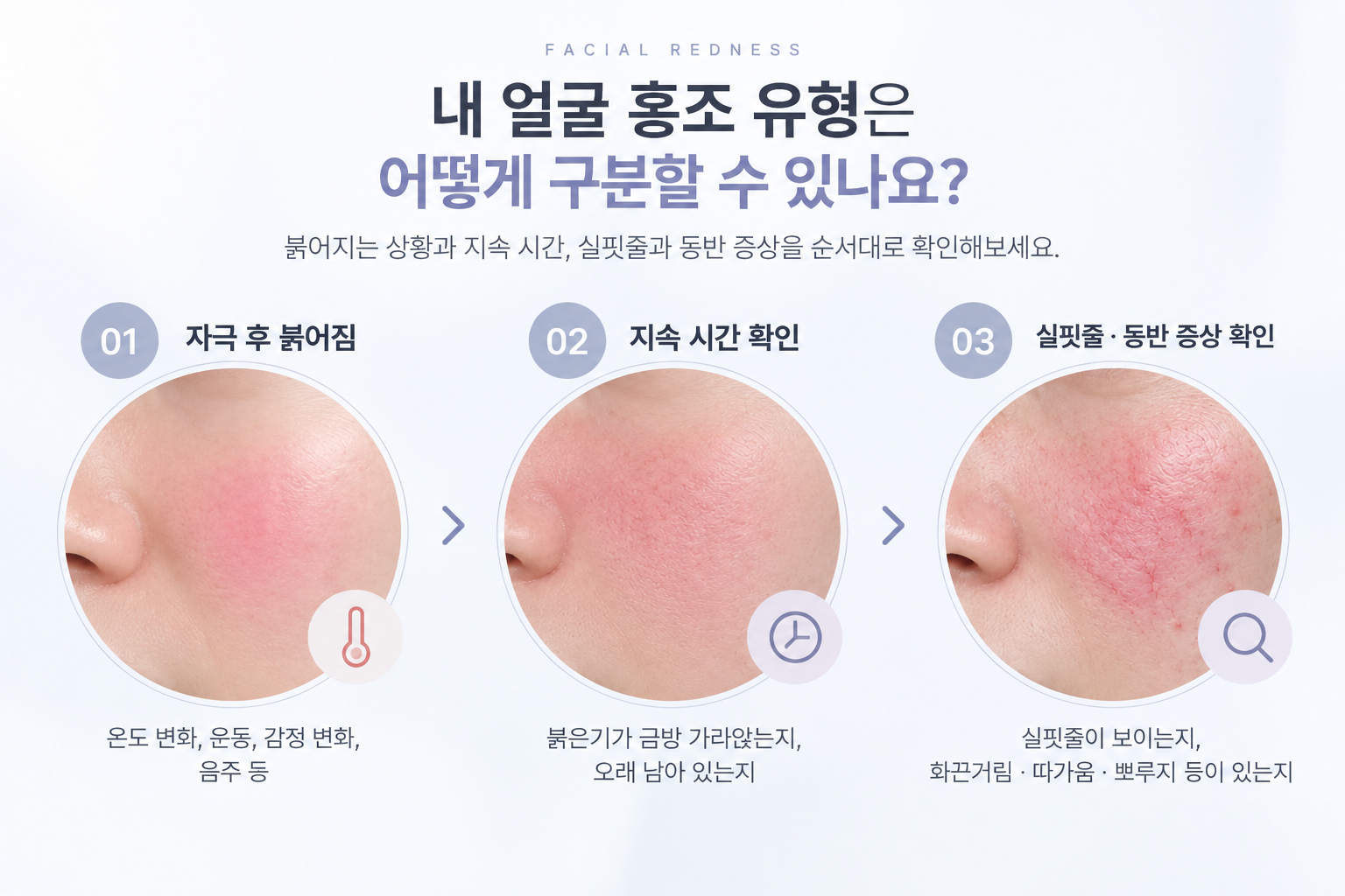 안면 홍조 치료 후 열 자극 마찰 보습 자외선 차단 관리