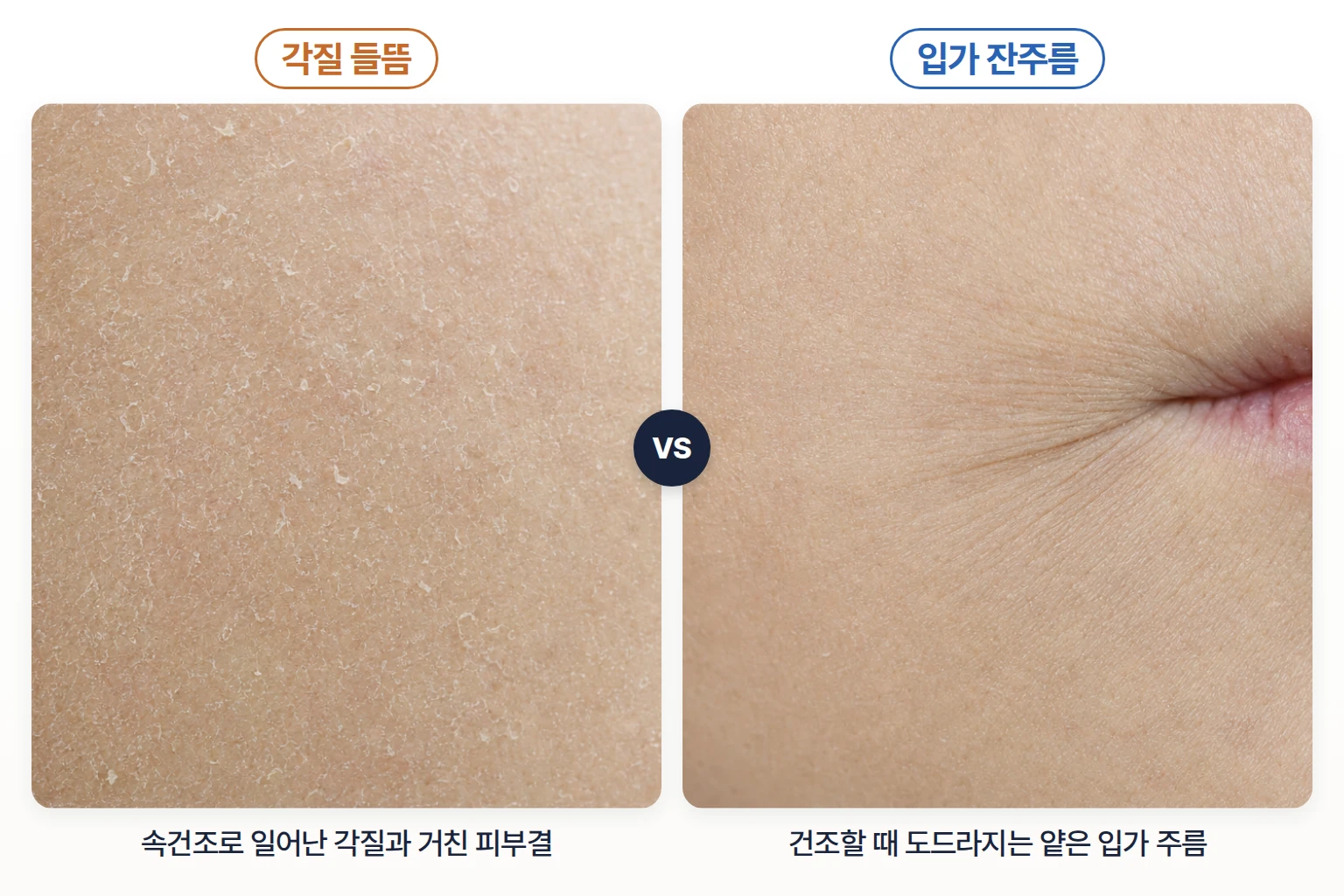 속건조로 각질이 들뜬 피부 표면과 입가 잔주름이 도드라진 모습을 확대해 나란히 비교한 사진