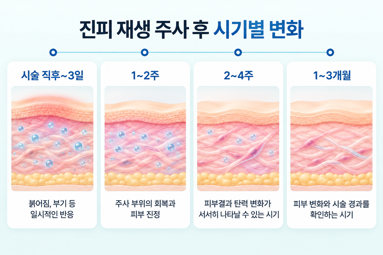 진피 재생 주사 직후 3일까지의 부기와 국소 반응, 1~2주 회복 과정, 2~4주 피부결 변화 가능 시점, 1~3개월 경과 관찰을 구분한 피부 단면