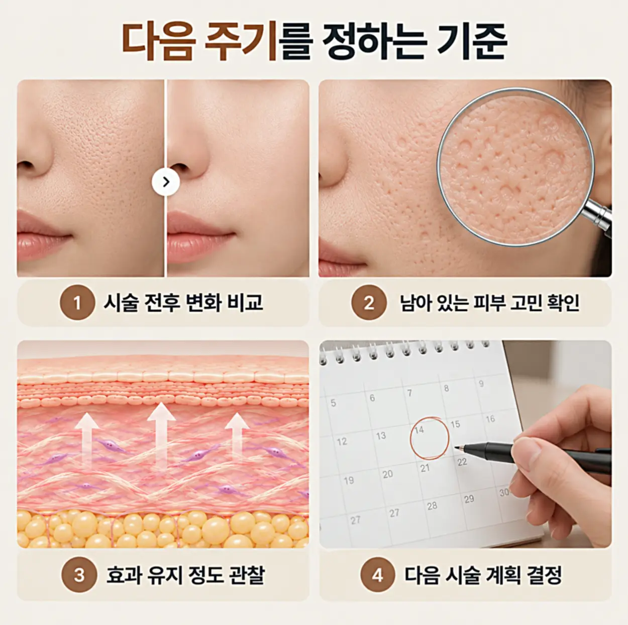 쥬베룩 다음 시술 주기를 정하는 기준인 시술 전후 피부 변화 비교, 남아 있는 모공·피부 고민 확인, 효과 유지 정도 관찰, 다음 시술 일정 결정을 나타낸 이미지