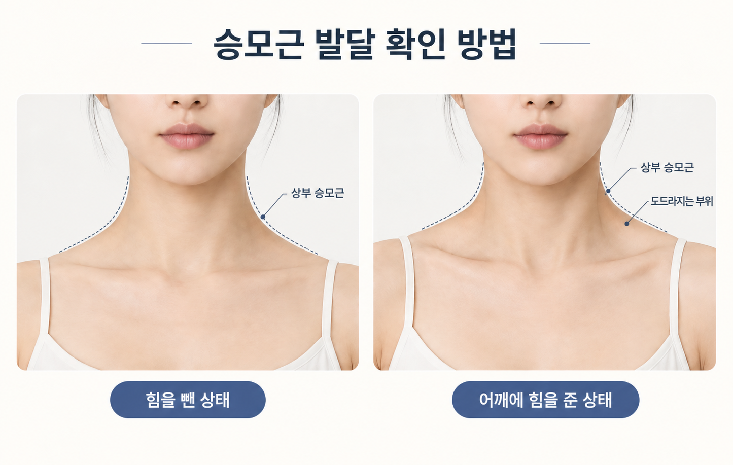 승모근 발달 여부를 확인하는 힘을 뺀 상태와 어깨에 힘을 준 상태 비교