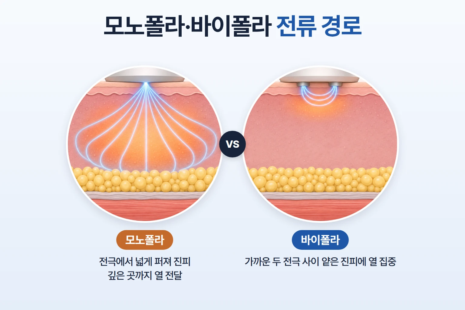 모노폴라의 넓고 깊은 전류 경로와 바이폴라의 두 전극 사이 얕은 경로를 비교한 피부 단면 도식