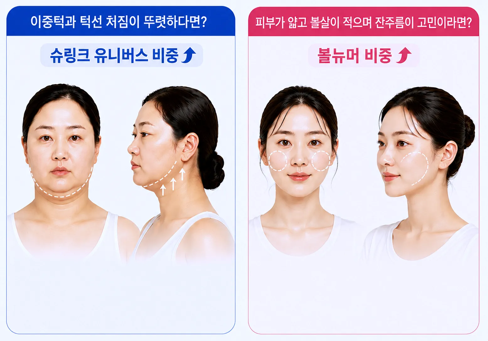 피부 상태에 따른 슈링크 볼뉴머 비중 구성 비교- 이중턱 턱선 처짐 잔주름 볼패임