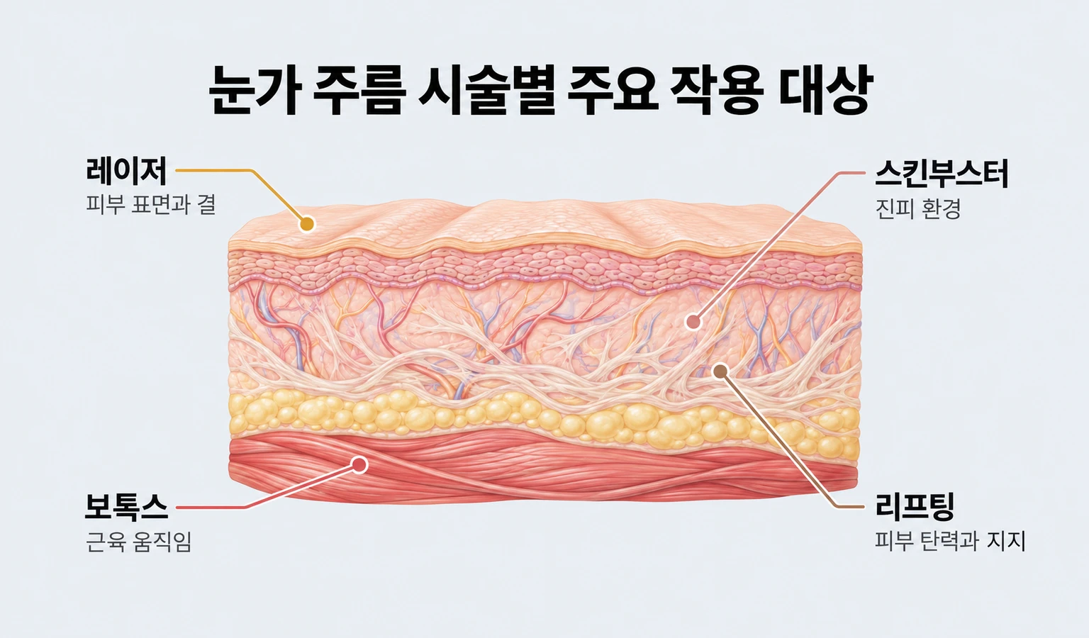 근육·피부 표면·진피·지지 구조로 구분한 눈가 주름 시술의 작용 대상