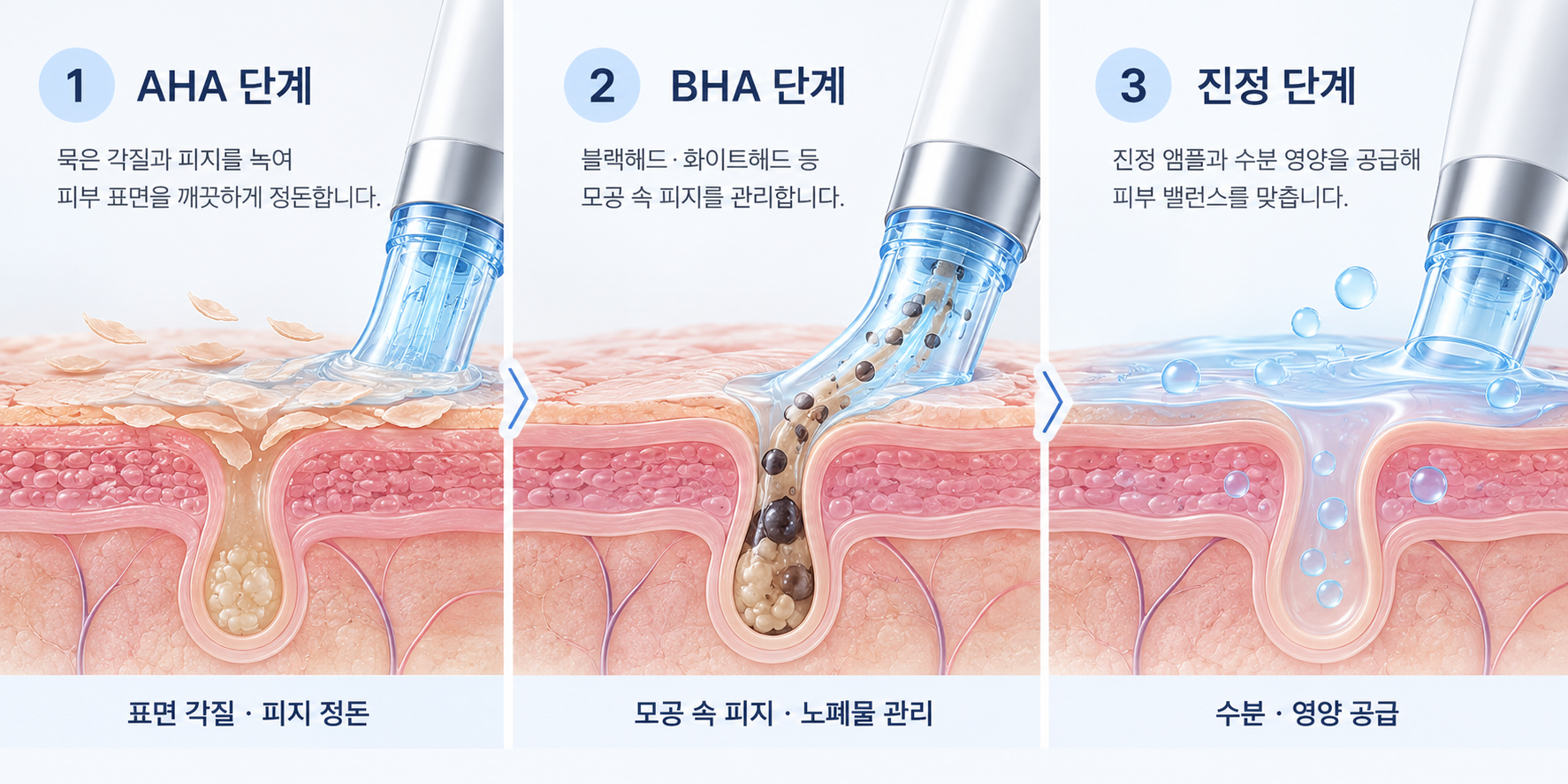 아쿠아필 AHA BHA 진정 3단계 진행 과정