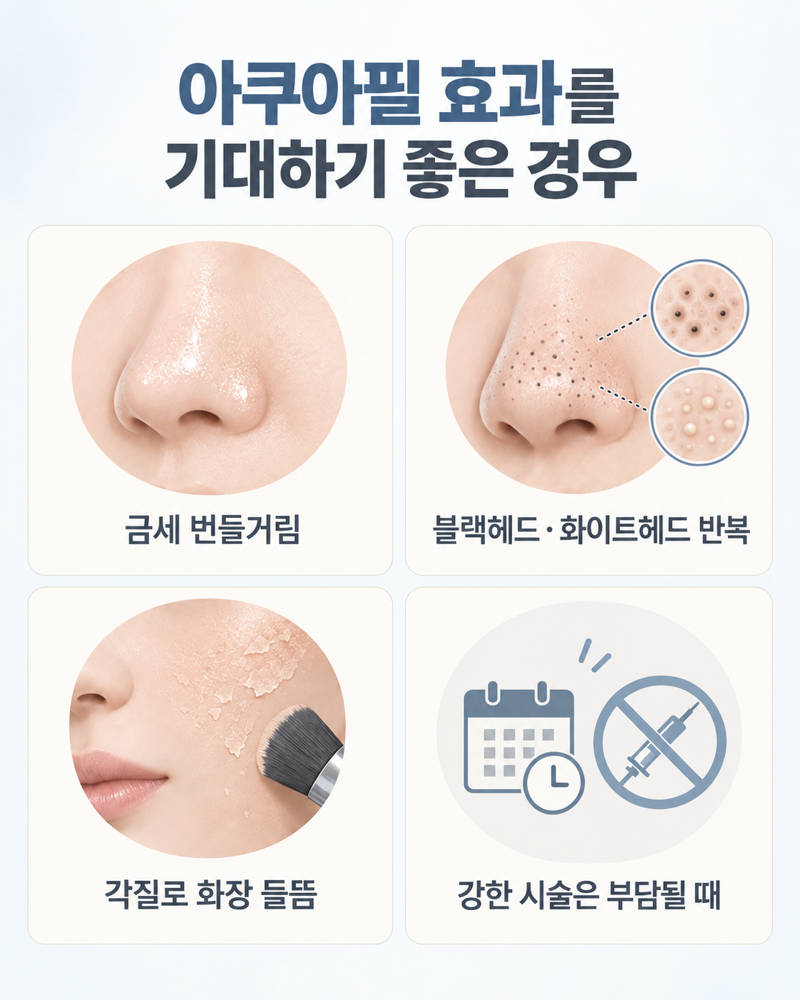 아쿠아필 효과를 기대하기 좋은 경우 - 번들거림 각질 블랙헤드 반복 강한 시술 부담