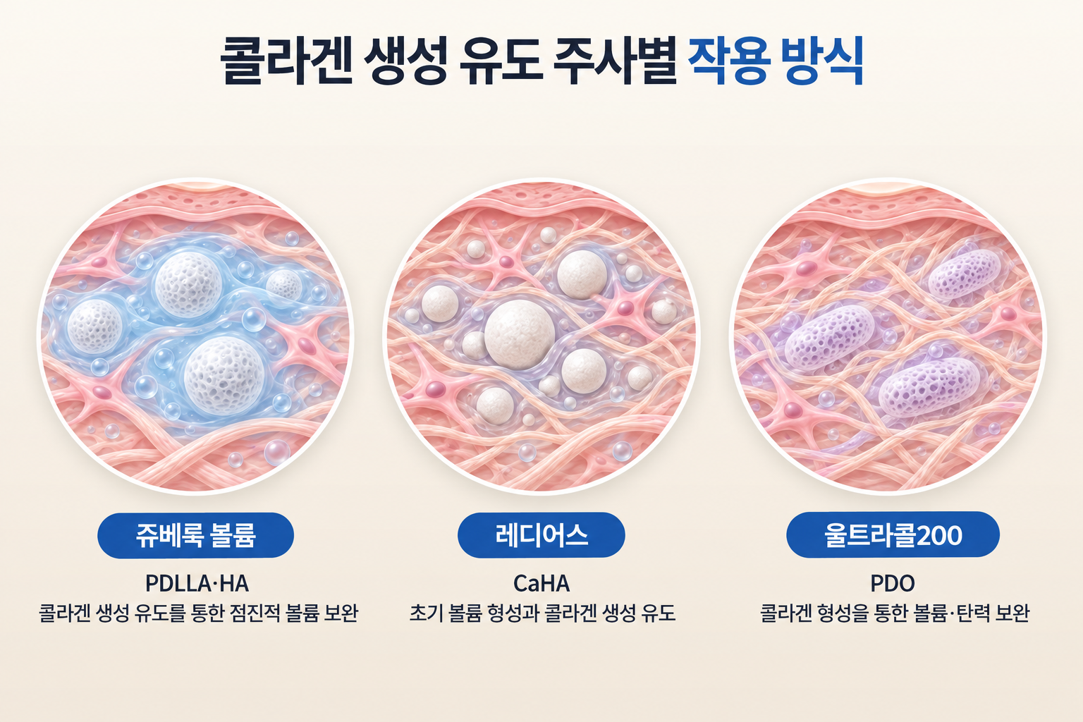 쥬베룩 볼륨 PDLLA·HA, 레디어스 CaHA, 울트라콜200 PDO의 피부 속 입자 분포와 콜라겐 생성 유도 방식 비교