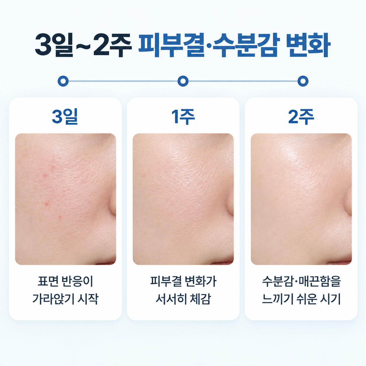 리쥬란 힐러 전후 피부 변화가 나타나는 시기