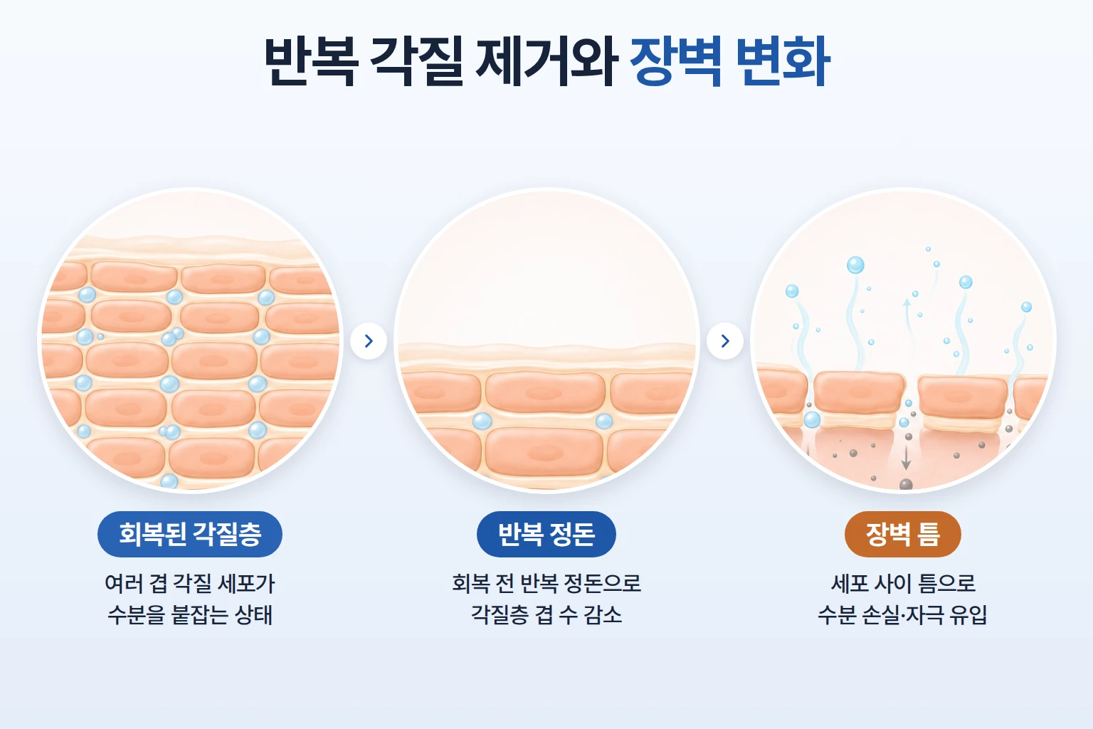 회복된 각질층, 얇아진 각질층, 틈이 벌어진 장벽을 단계별로 확대해 나타낸 피부 장벽 모식도