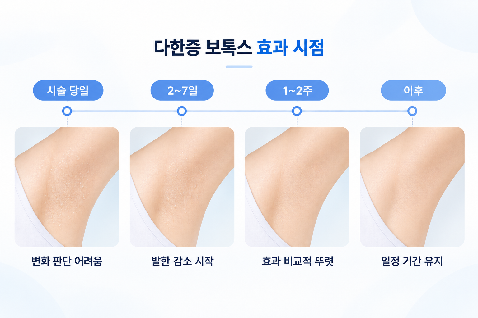 다한증 보톡스 시술 당일부터 2~7일 1~2주 이후의 발한 감소 변화
