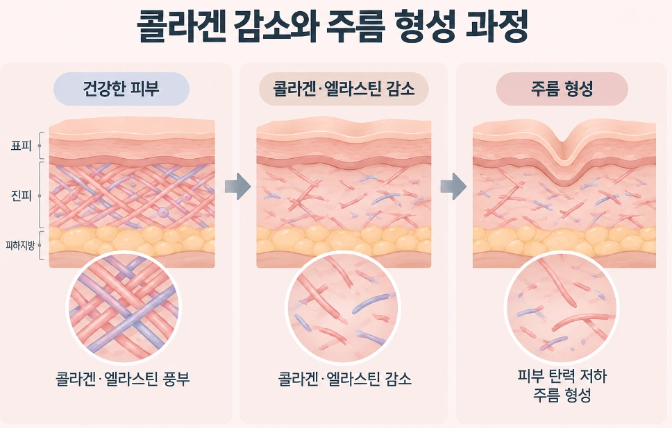 콜라겐과 엘라스틴 감소에 따른 피부 탄력 저하와 주름 형성 과정