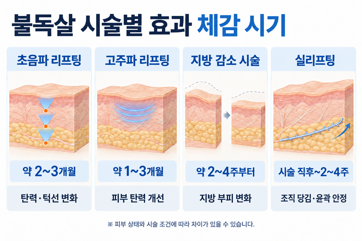 초음파 리프팅, 고주파 리프팅, 지방 감소 시술, 실리프팅의 불독살 개선 효과와 체감 시기를 비교한 이미지
