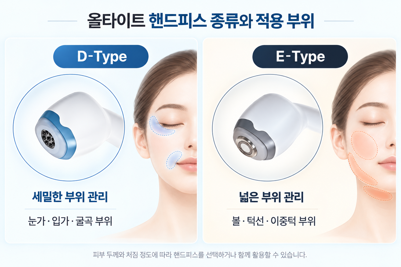 올타이트 리프팅 D-Type과 E-Type 핸드피스 구조 및 눈가·입가·볼·턱선 적용 부위 비교