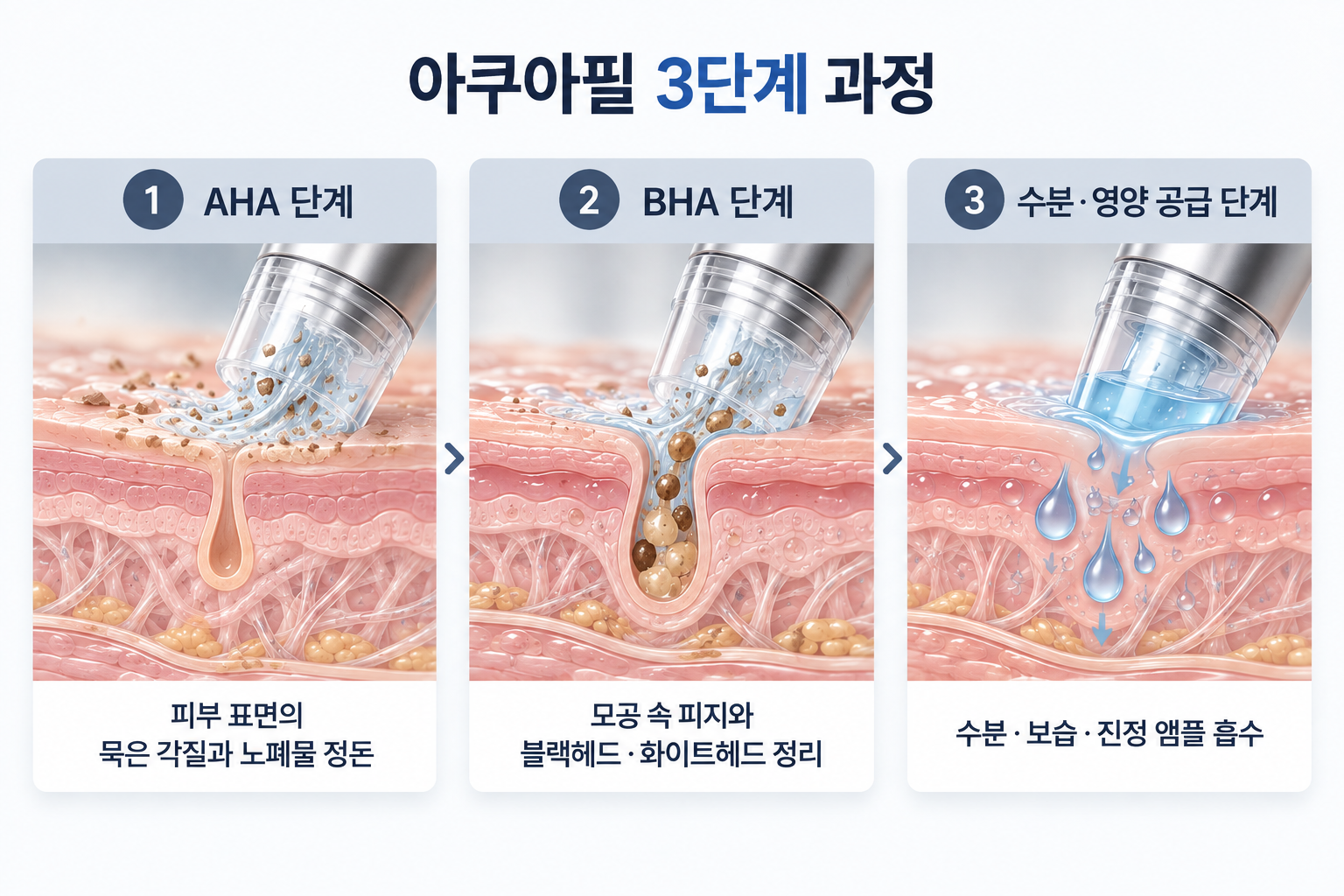 아쿠아필 3단계 과정 - AHA, BHA, 수분 영양 공급
