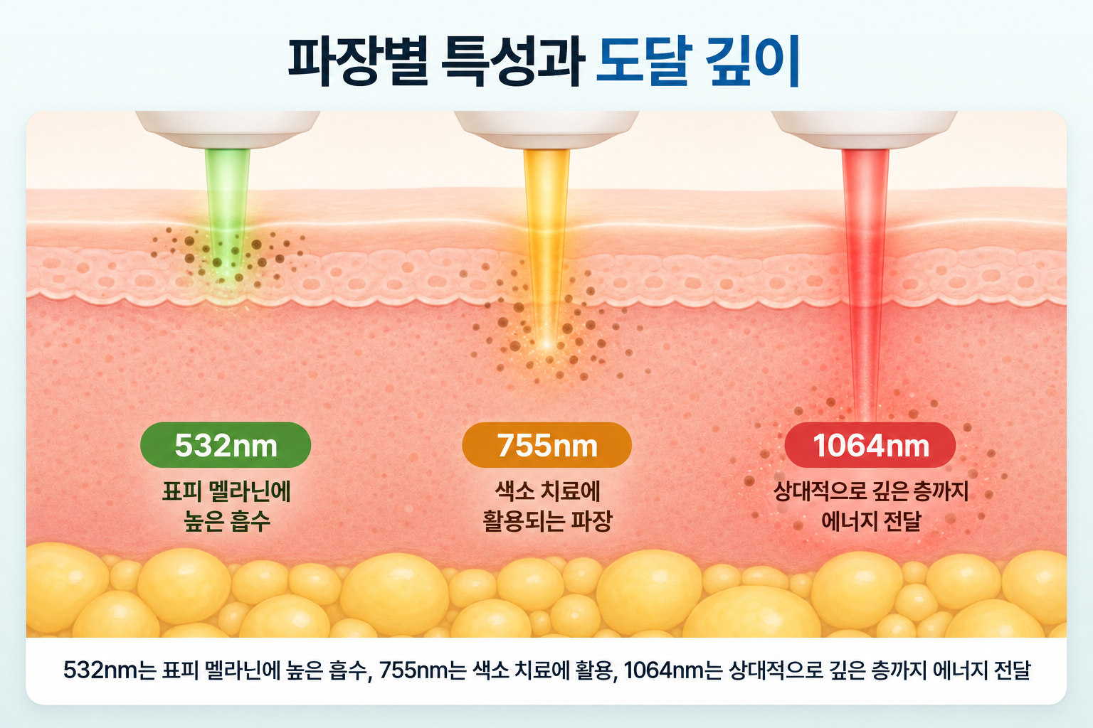 532nm의 표피 멜라닌 흡수, 755nm의 색소 치료 활용, 1064nm의 상대적으로 깊은 피부층 도달 특성을 비교한 피부 단면