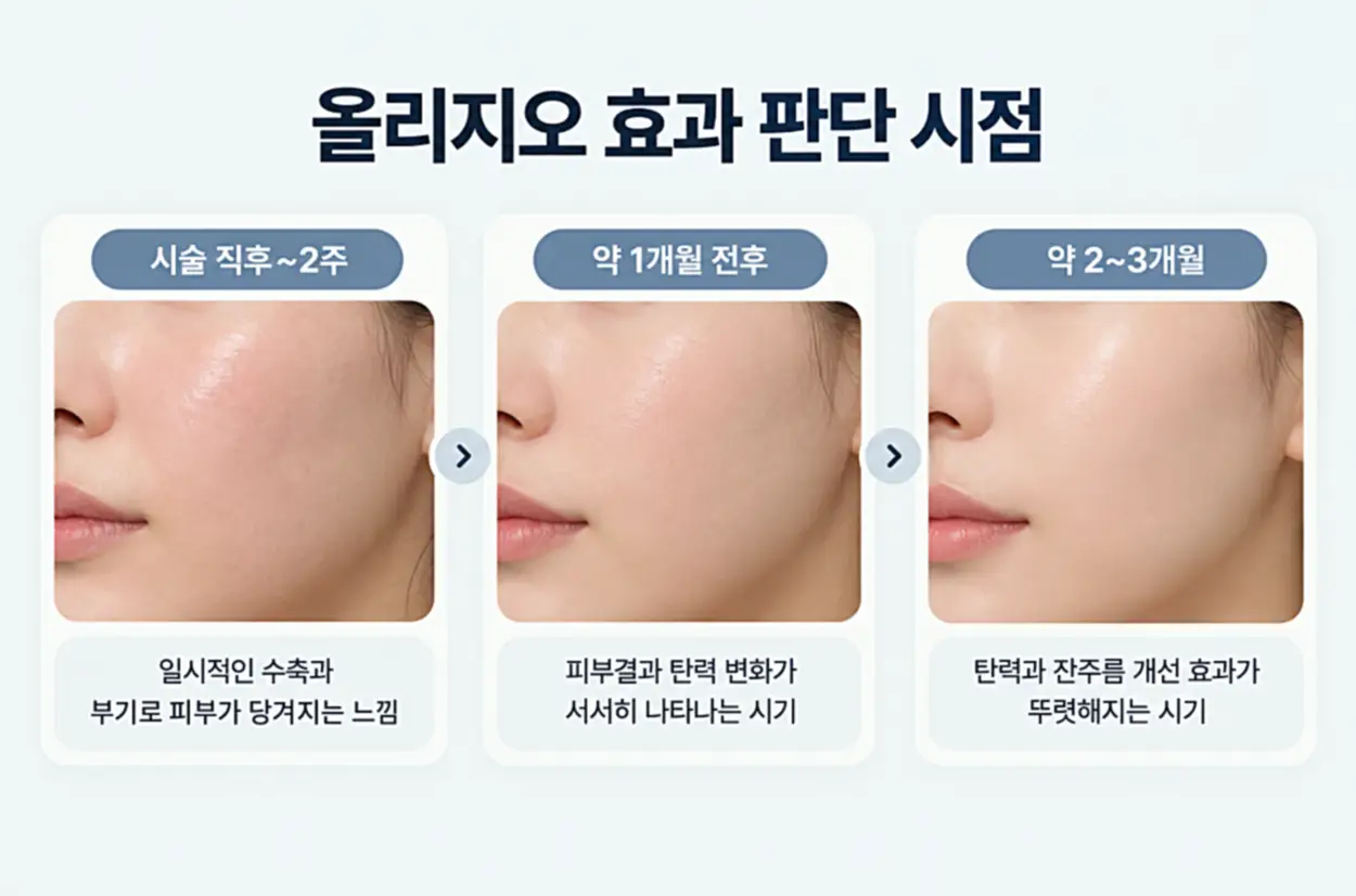 올리지오 시술 후 효과 판단 시점을 직후~2주, 약 1개월, 2~3개월로 나누어 피부 탄력과 잔주름의 변화 과정을 비교한 이미지
