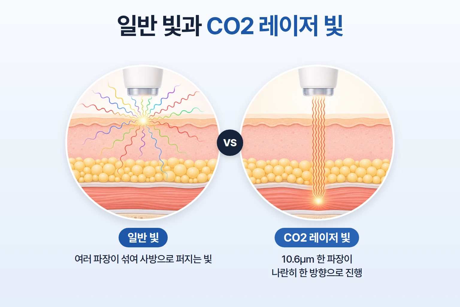 여러 파장이 사방으로 퍼지는 일반 빛과 같은 파장이 나란히 직진하는 레이저 빛을 비교한 일러스트