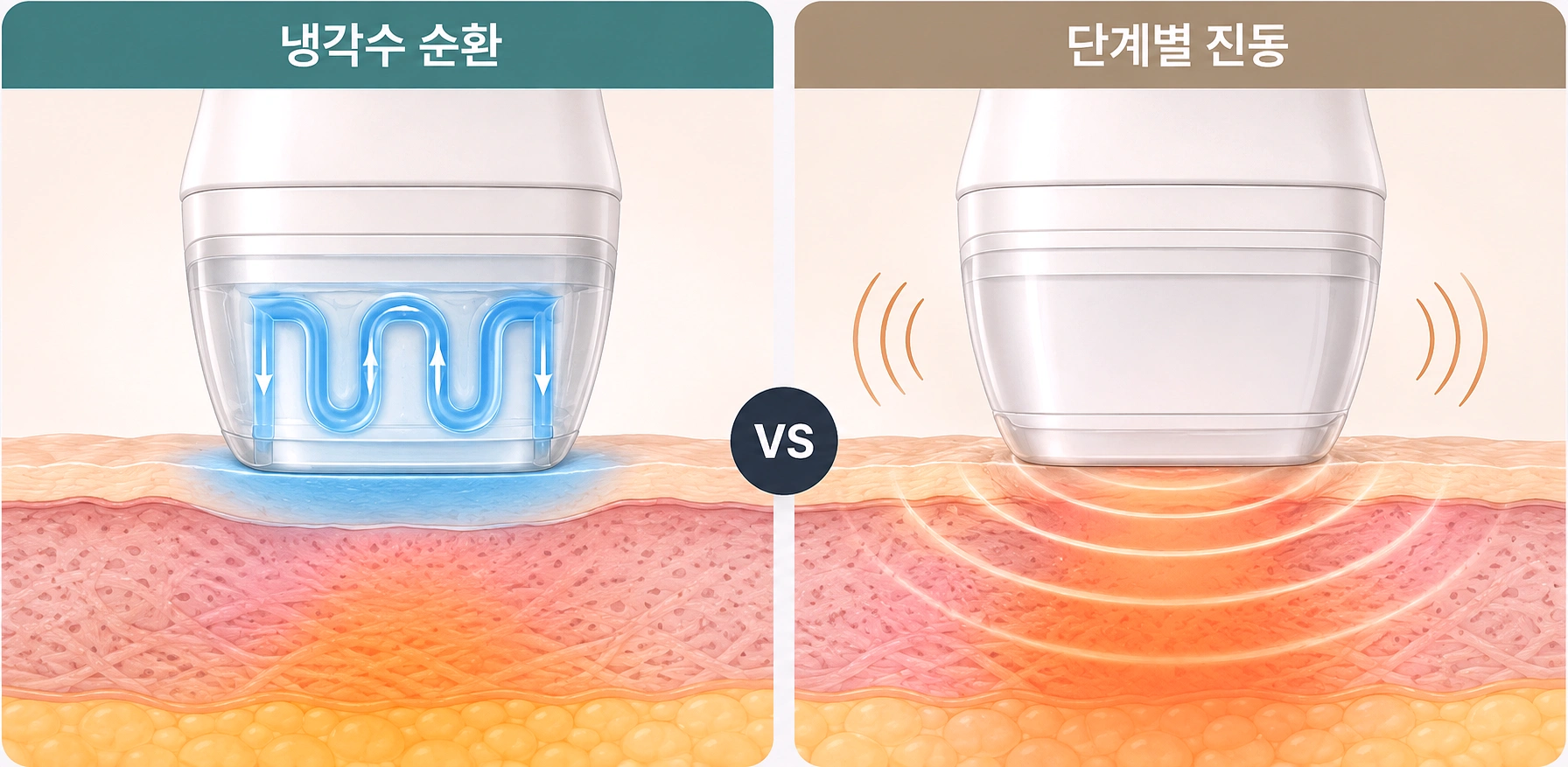 볼뉴머 시술 시 냉각수 순환과 단계별 진동이 피부 표면의 열 자극과 시술 중 느껴지는 감각을 조절하는 방식을 비교한 인포그래픽