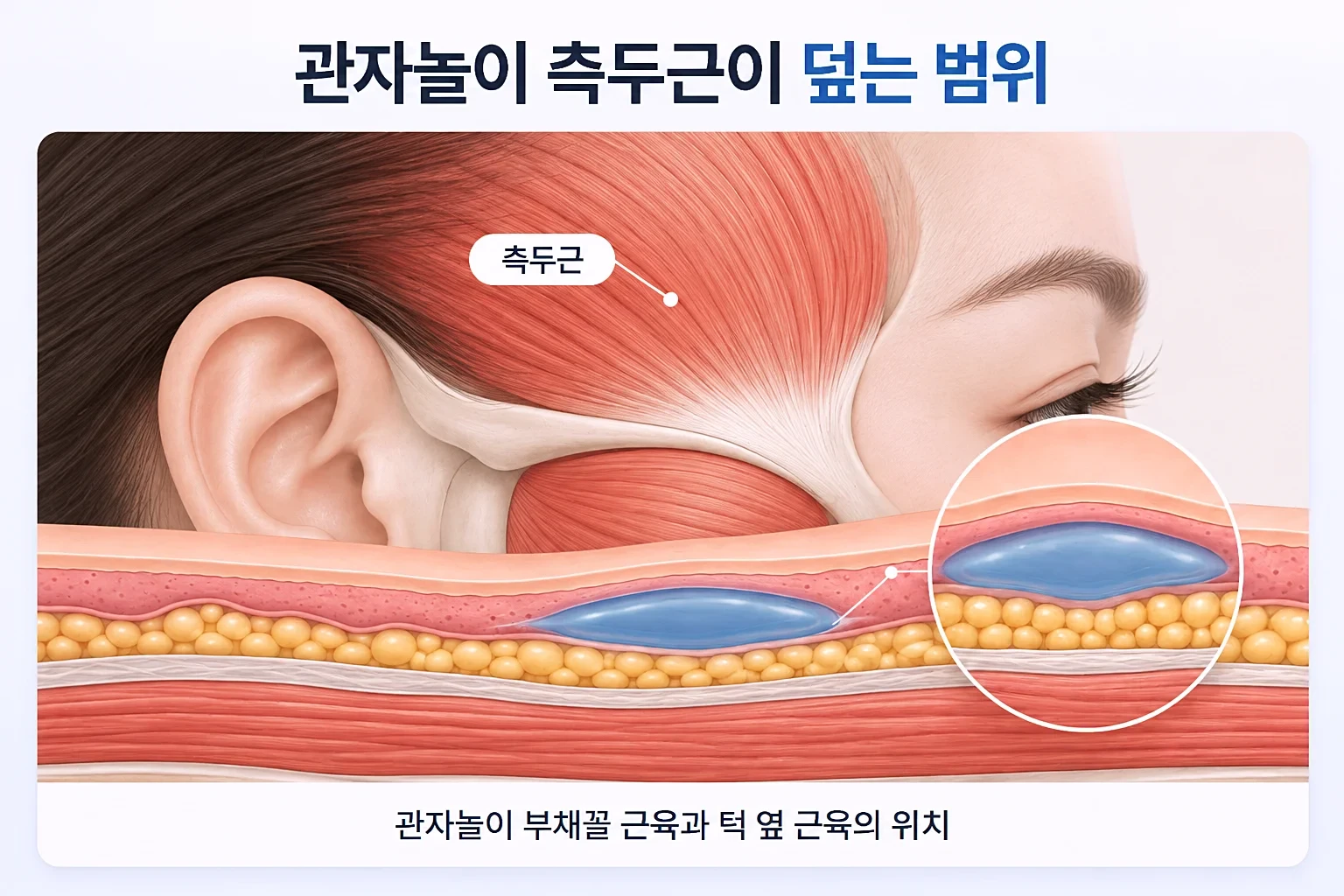 관자놀이에서 귀 위까지 부채꼴로 퍼진 측두근과 턱 옆 교근의 위치를 나타낸 해부 모식도