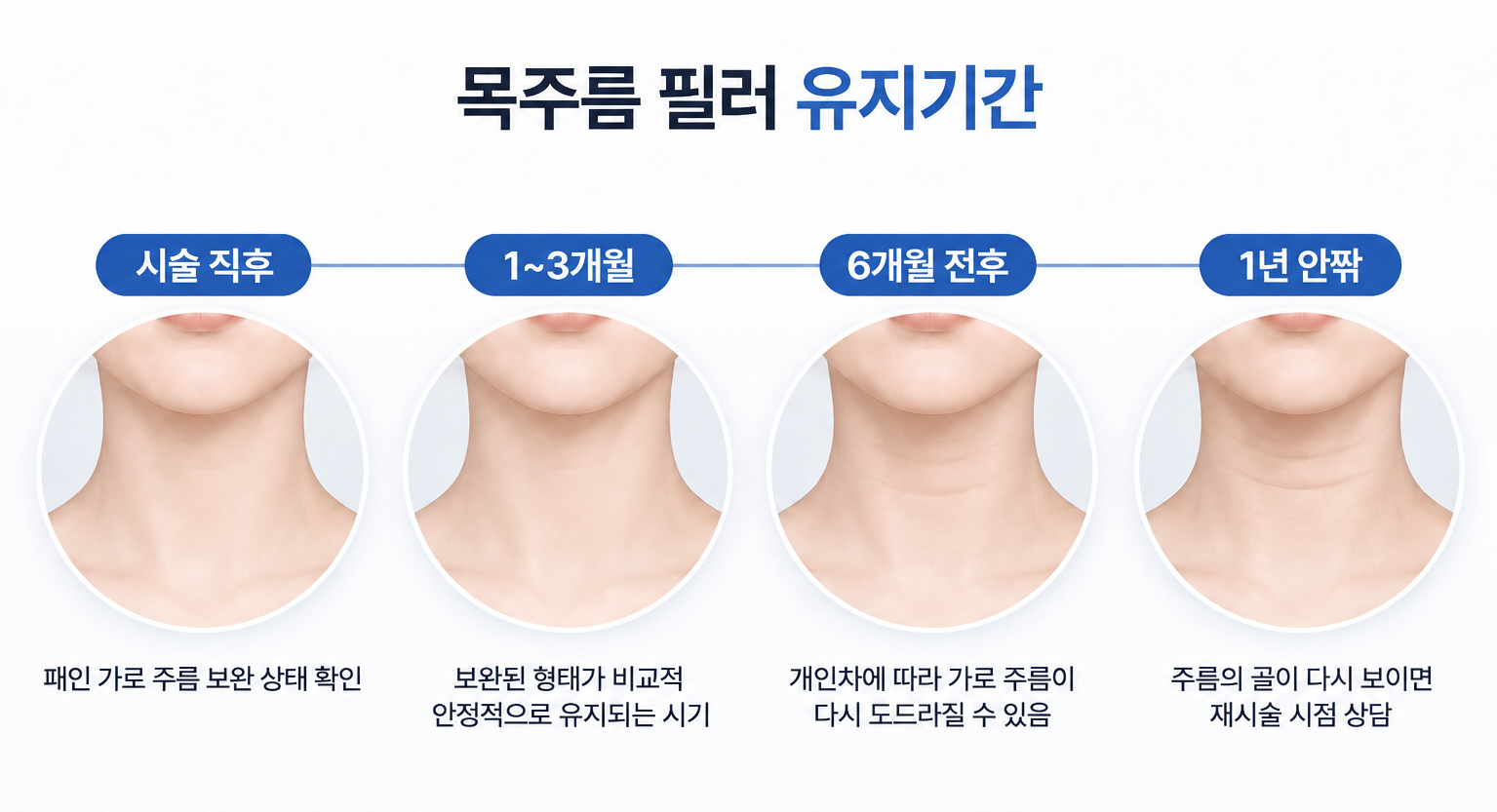 목주름 필러 유지기간에 따른 가로 주름 변화와 재시술 판단 시점