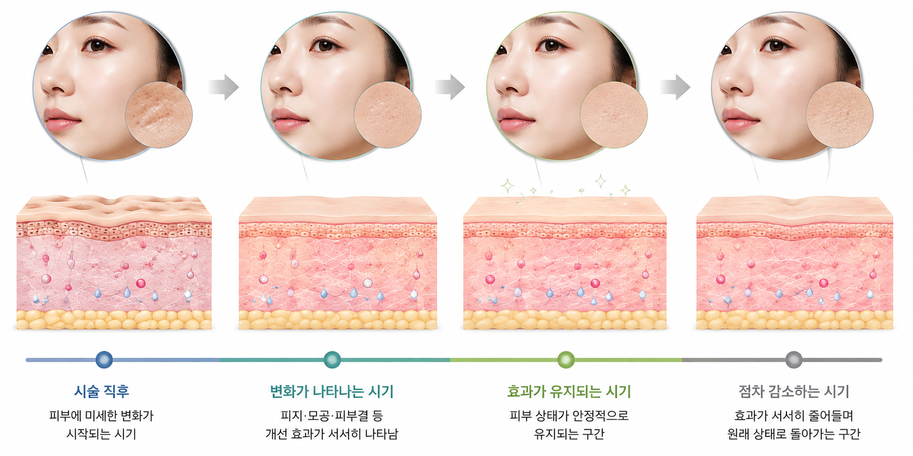 스킨보톡스 시술 직후 변화 시작 유지 감소 단계의 피부 변화 타임라인