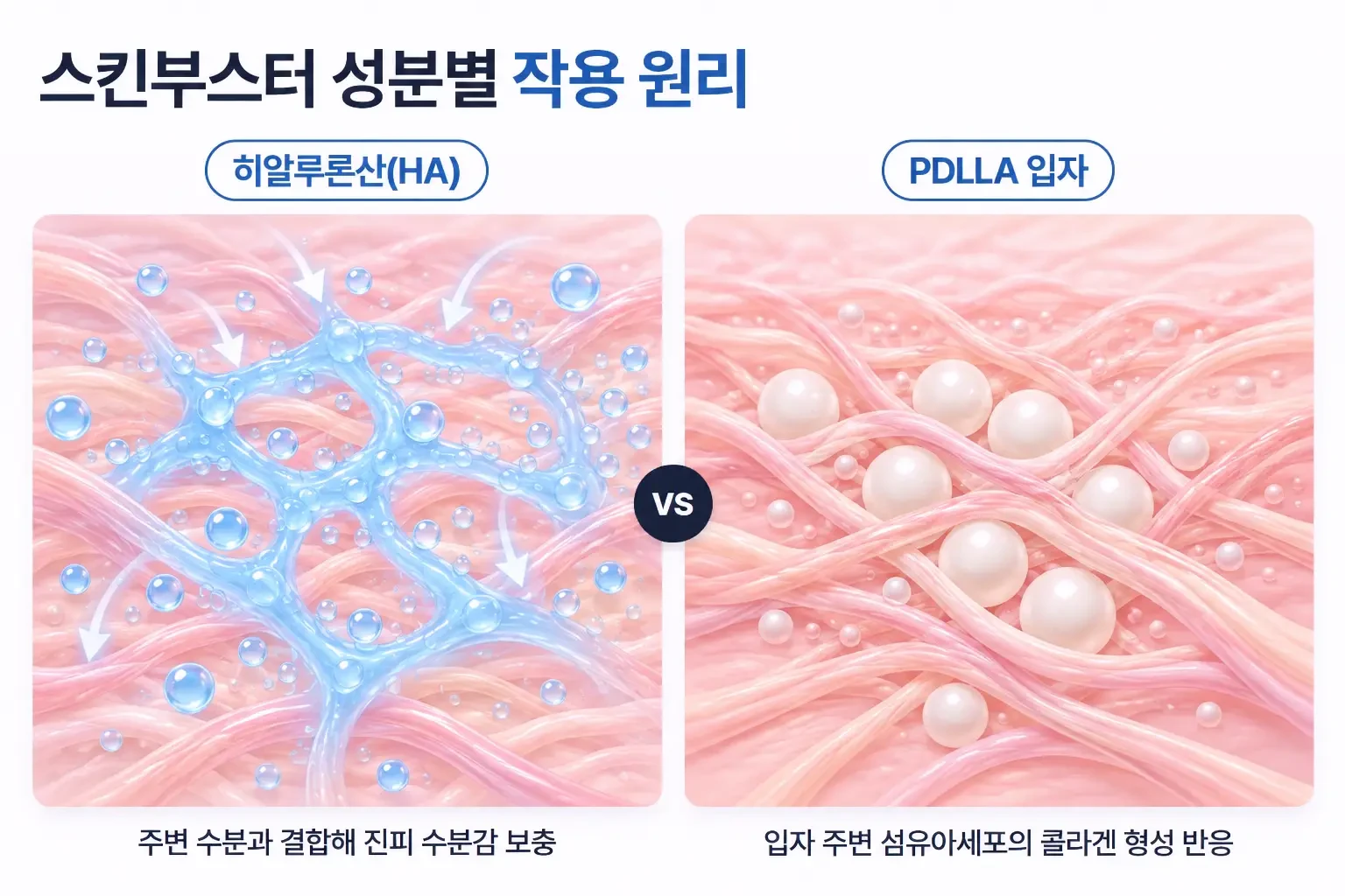 히알루론산의 수분 결합과 PDLLA 입자 주변 콜라겐 형성을 나란히 비교한 작용 원리 개념도