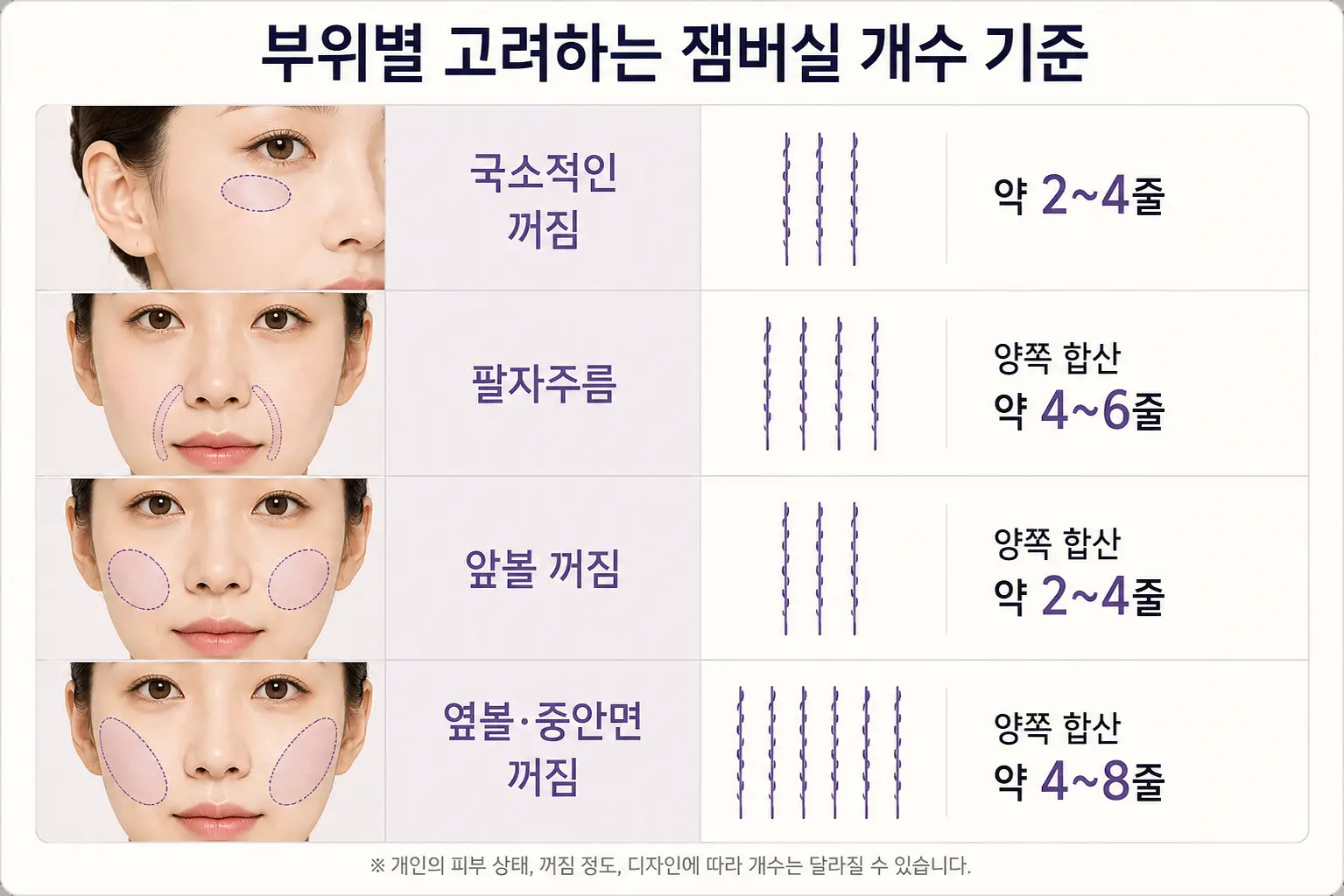 팔자·앞볼·옆볼 등 부위별로 고려하는 잼버실 개수 기준
