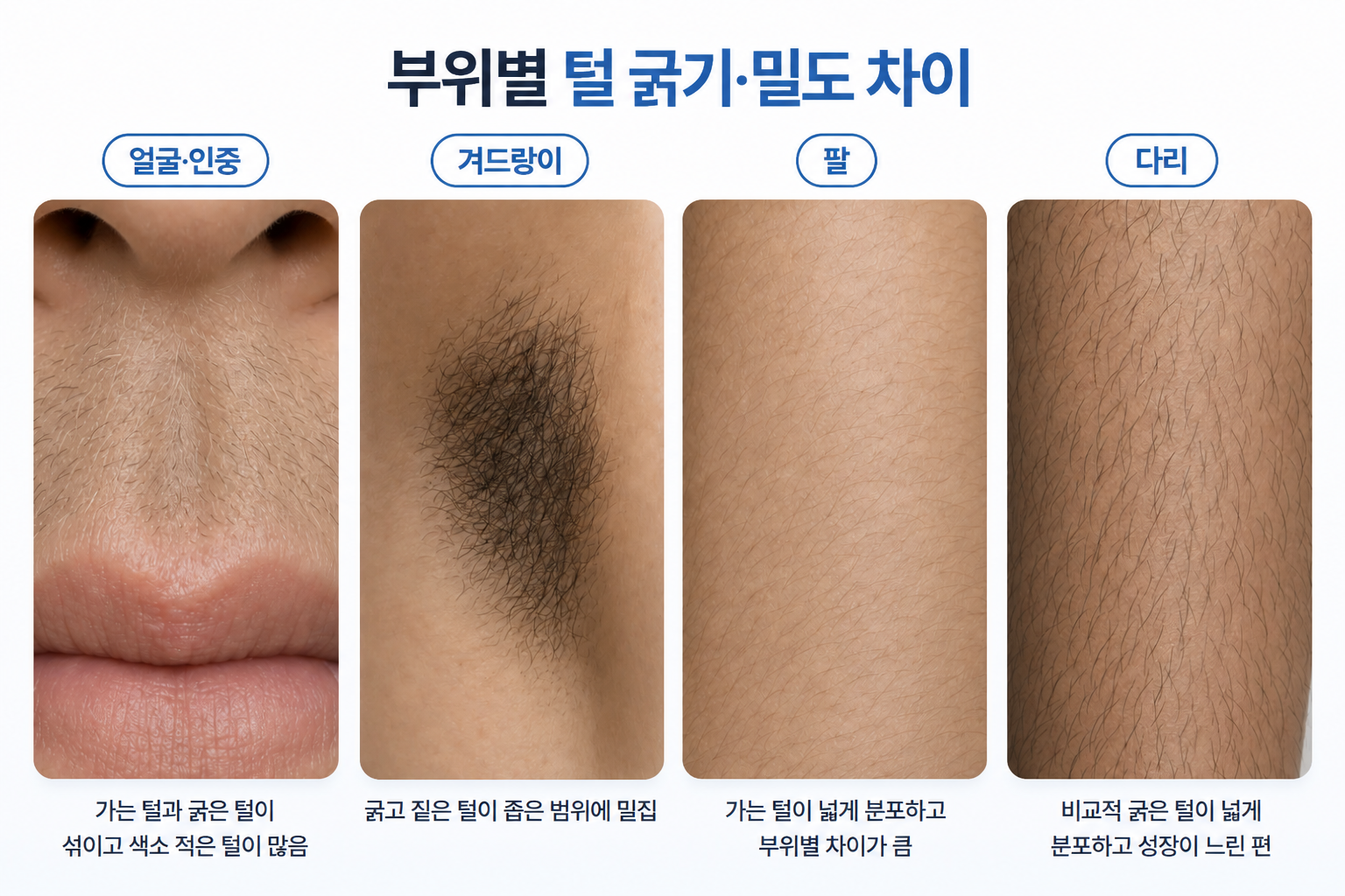 얼굴 인중의 가는 털, 겨드랑이의 굵고 밀집된 털, 팔의 가는 털과 다리의 비교적 굵은 털 차이