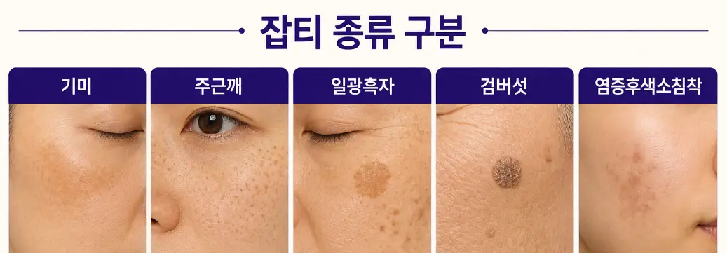 잡티 종류를 구분하는 기준과 예시 사진