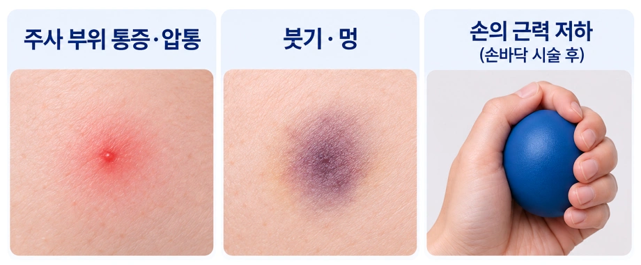 다한증 보톡스 후 나타날 수 있는 통증·붓기·멍과 손 근력 저하