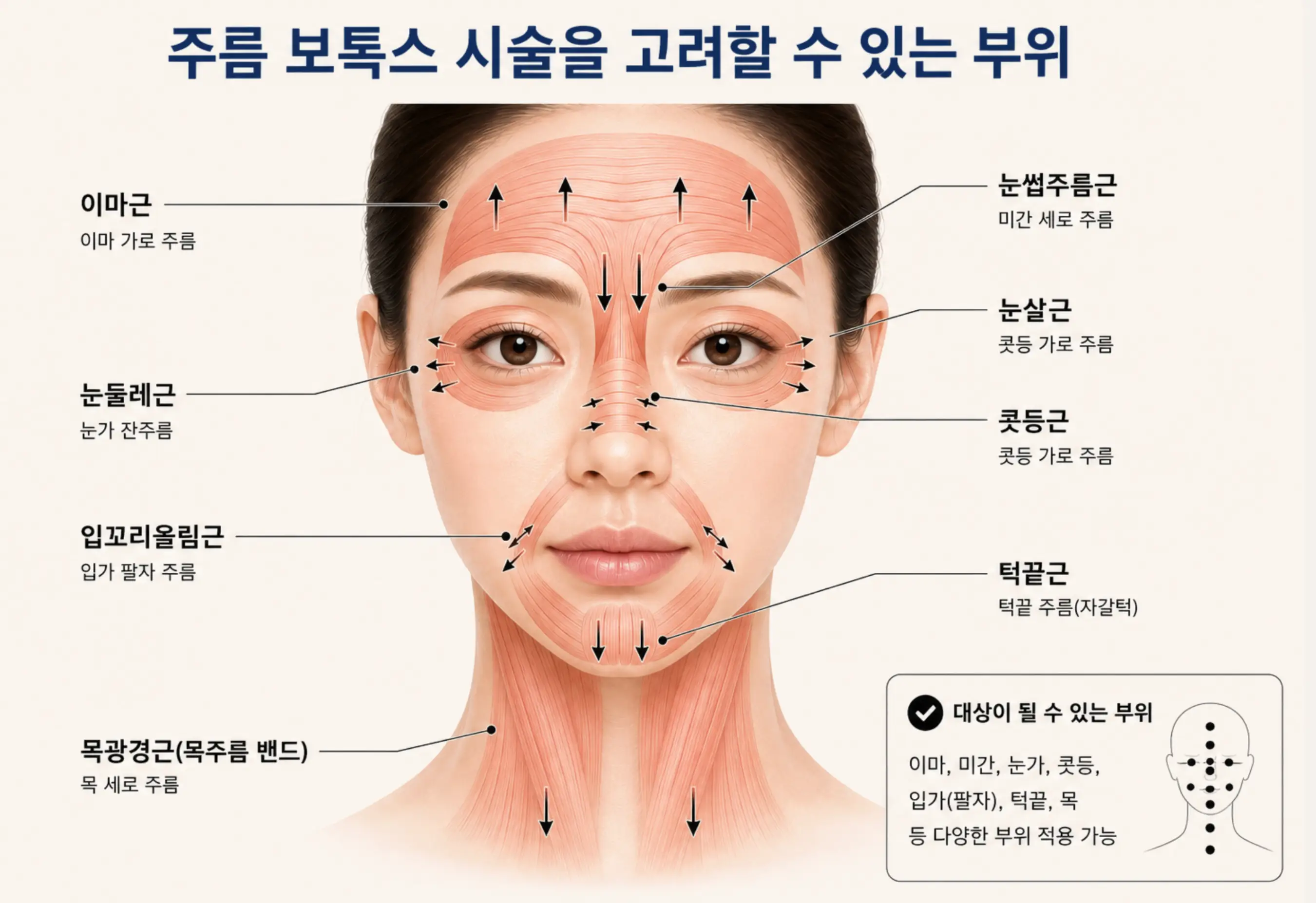 이마근 눈썹주름근 눈살근 눈둘레근 등 주름 보톡스 시술 고려 부위 및 표정근 위치