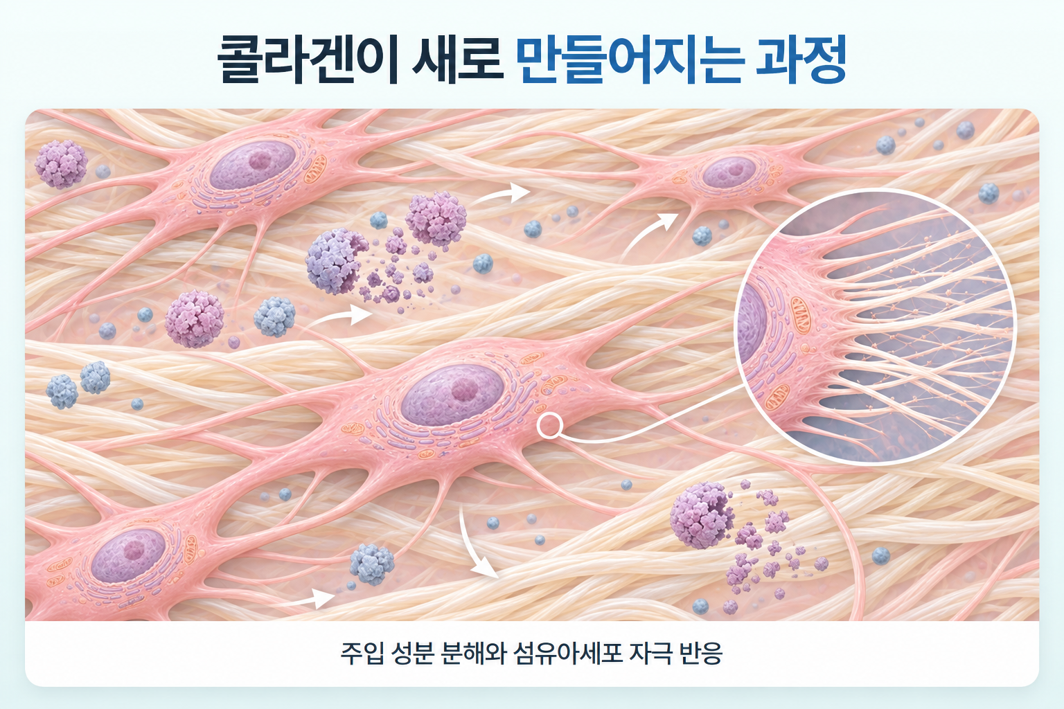 주입 성분 분해와 섬유아세포 자극에 따른 콜라겐 형성 과정