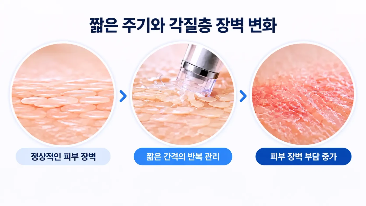 촘촘한 각질층, 반복 제거로 생긴 틈, 틈 사이 수분 증발을 단계별로 그린 장벽 구조 개념도