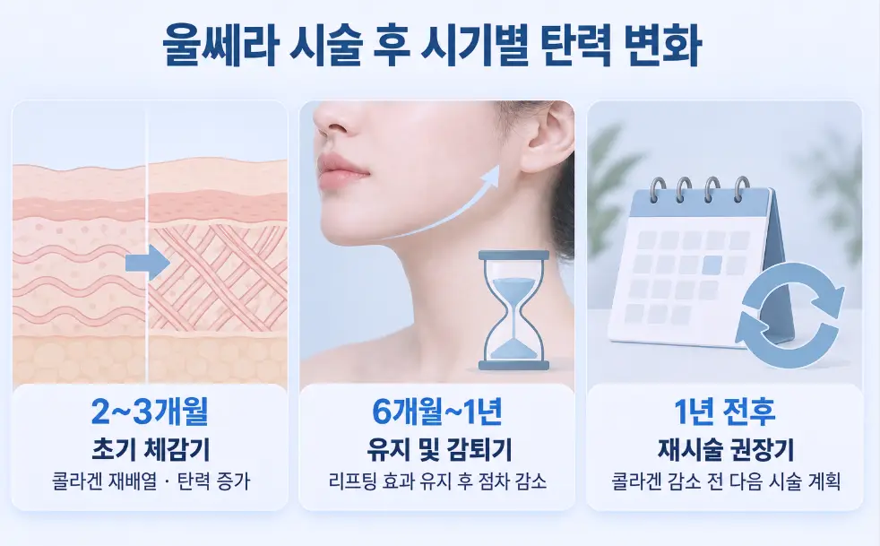 울쎄라 시술 후 2~3개월 초기 콜라겐 재배열, 6개월~1년 효과 유지 및 감소, 1년 전후 재시술 계획을 나타낸 시기별 탄력 변화 인포그래픽