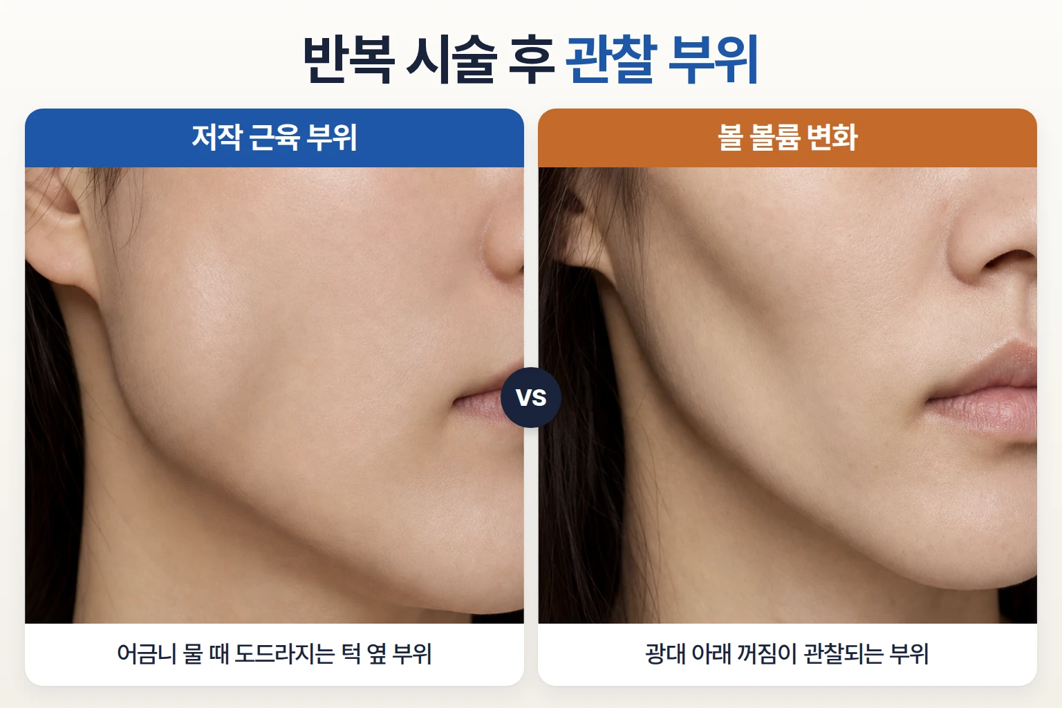 턱 옆 저작 근육 부위와 광대 아래 볼 꺼짐이 관찰되는 부위를 나란히 담은 비교 사진