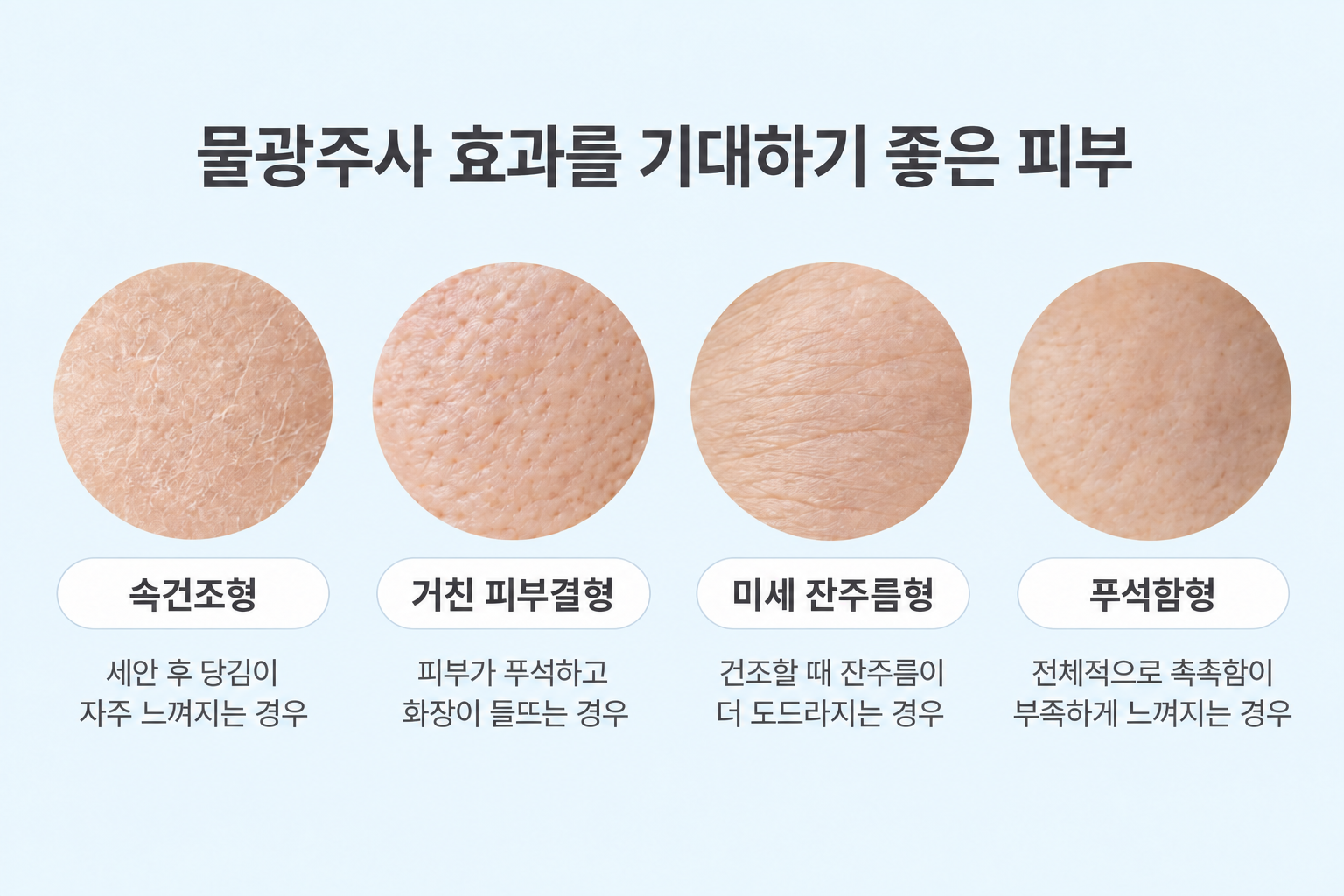 속건조 거친 피부결 미세 잔주름 푸석함 등 물광주사 효과를 기대하기 좋은 피부 상태