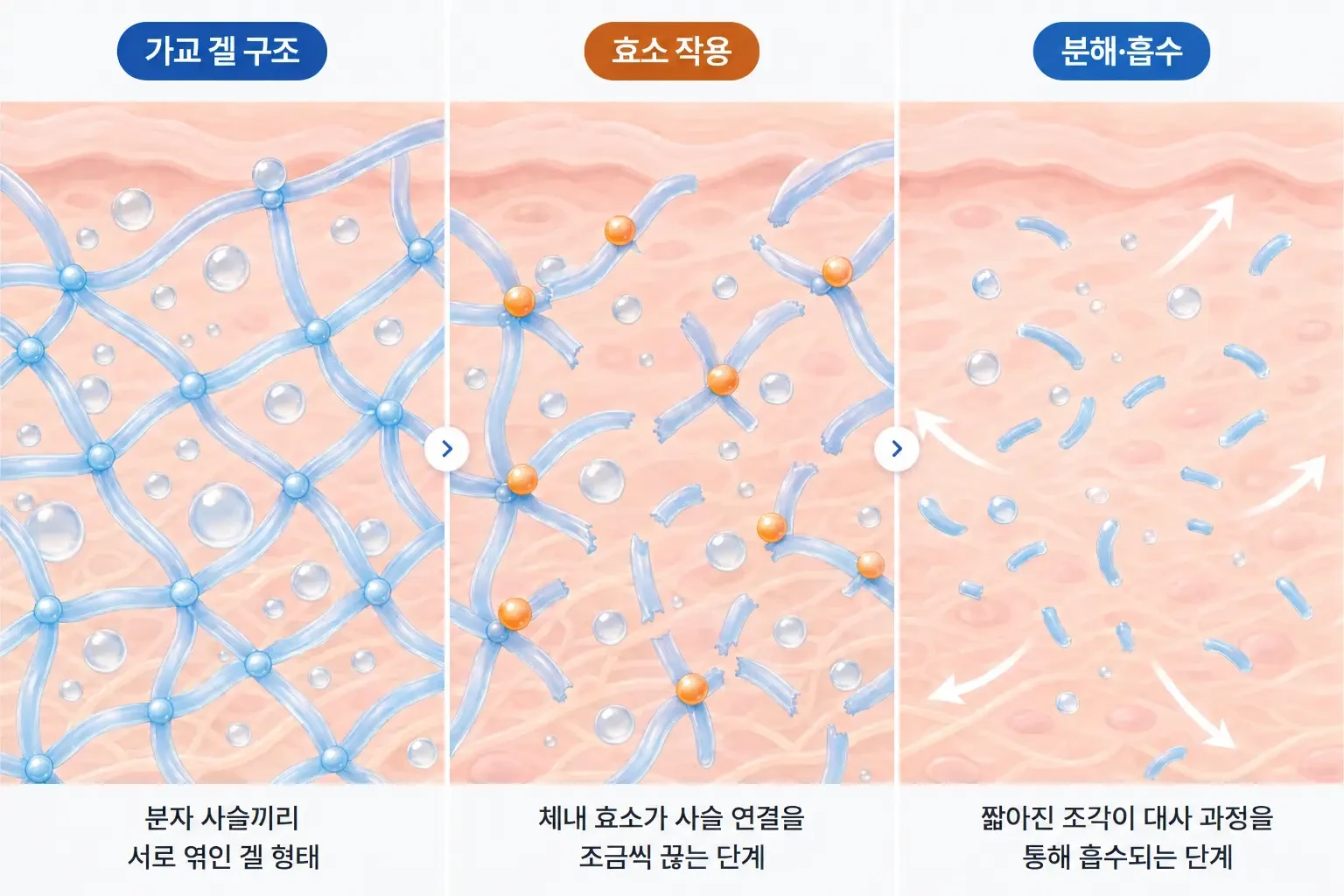 사슬처럼 엮인 가교 히알루론산 겔이 효소에 끊어져 흡수되는 과정을 단계별로 나타낸 개념도