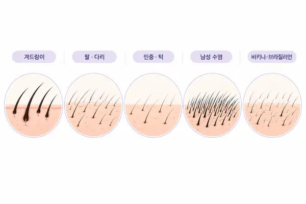부위별 털 굵기와 밀도 차이를 비교