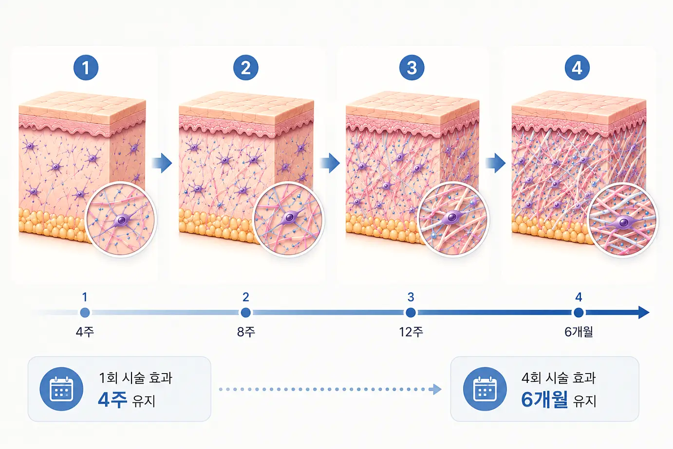 리쥬란 힐러 시술 후 엠보싱 흡수부터 효과 체감까지 시기별 경과 타임라인