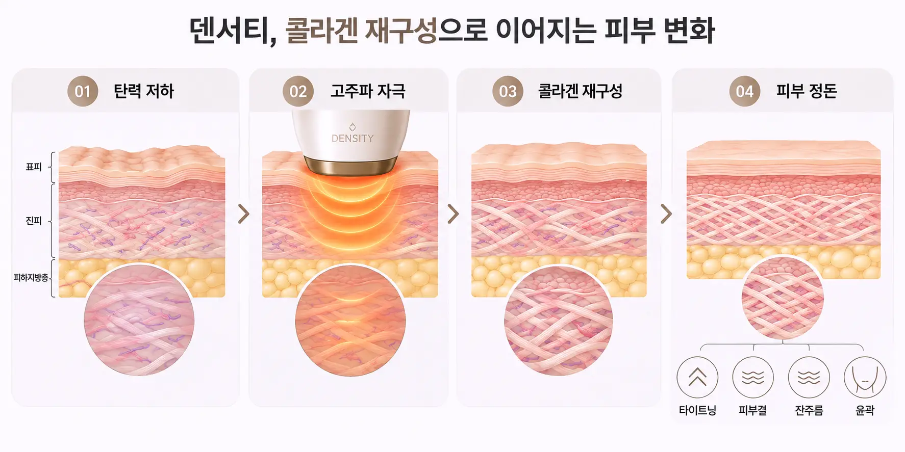 덴서티효과