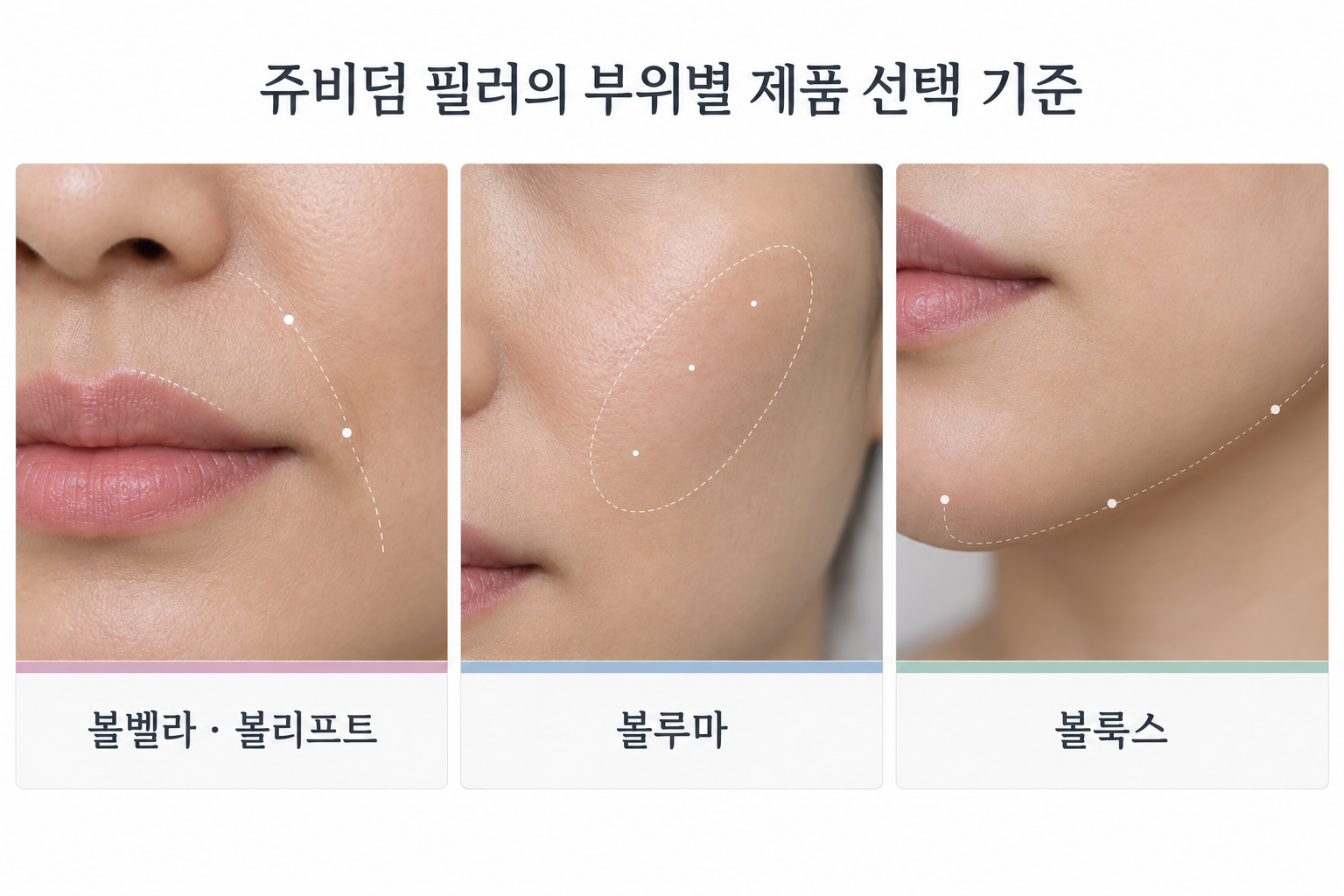 쥬비덤 필러 부위별 선택 기준과 얼굴 주름·입술, 안면부, 턱에 활용되는 제품을 보여주는 이미지