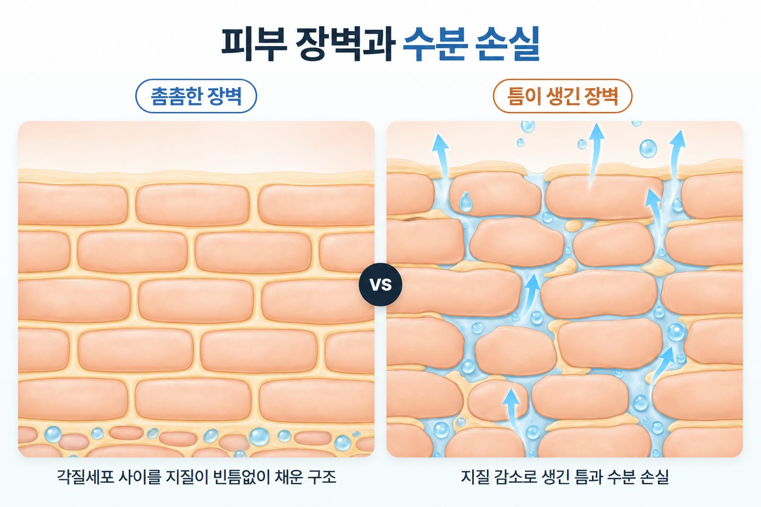 각질세포 사이를 지질이 촘촘히 채운 피부 장벽과 세포간지질 감소로 틈이 생겨 수분이 빠져나가는 피부 장벽 비교