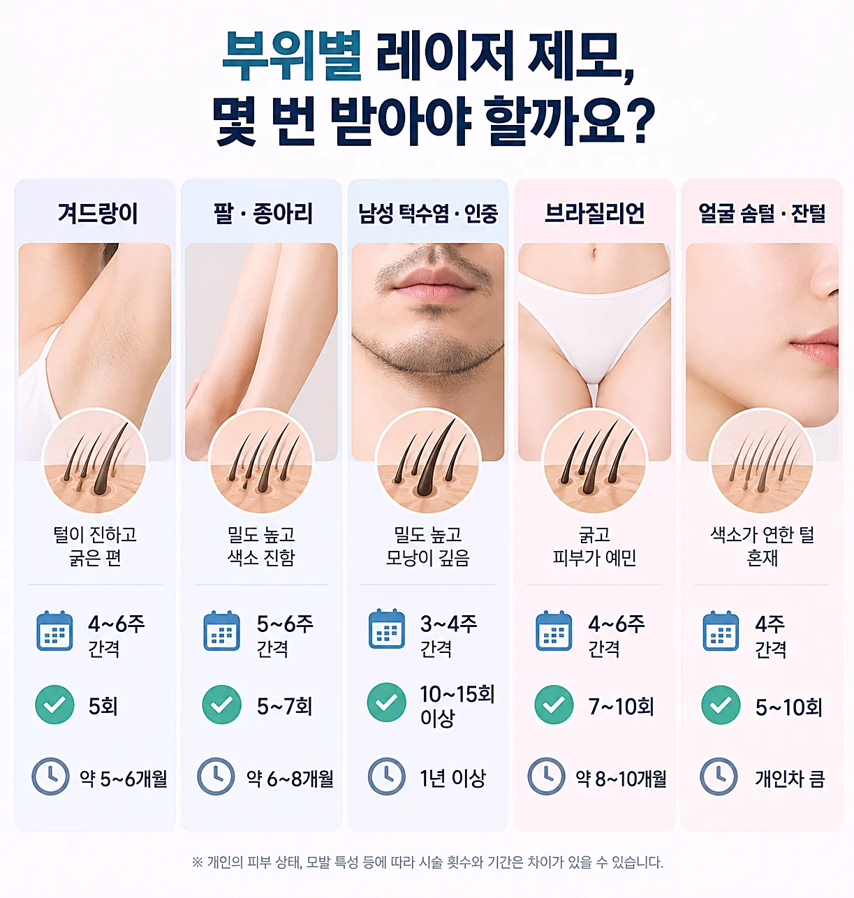 레이저 제모 부위별 완주 기간 비교 - 팔다리 겨드랑이 수염