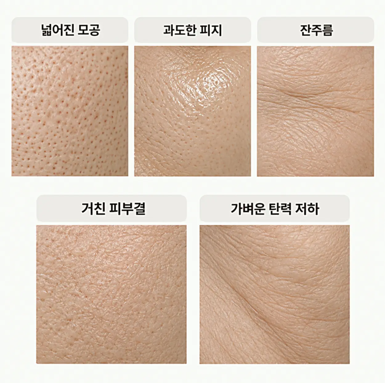스킨보톡스 효과를 기대할 수 있는 피부 고민 5가지