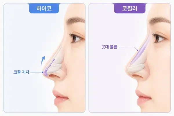 코 내부 흡수성 실의 위치와 코끝을 위쪽으로 지지하는 원리
